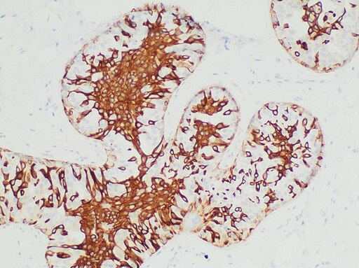Microscopic image of cytokeratin 5/6