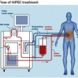 HIPEC diagram