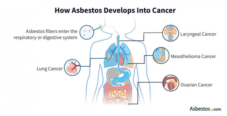 asbestos exposure symptoms