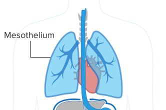 graphic showing mesothelium, lining around lungs