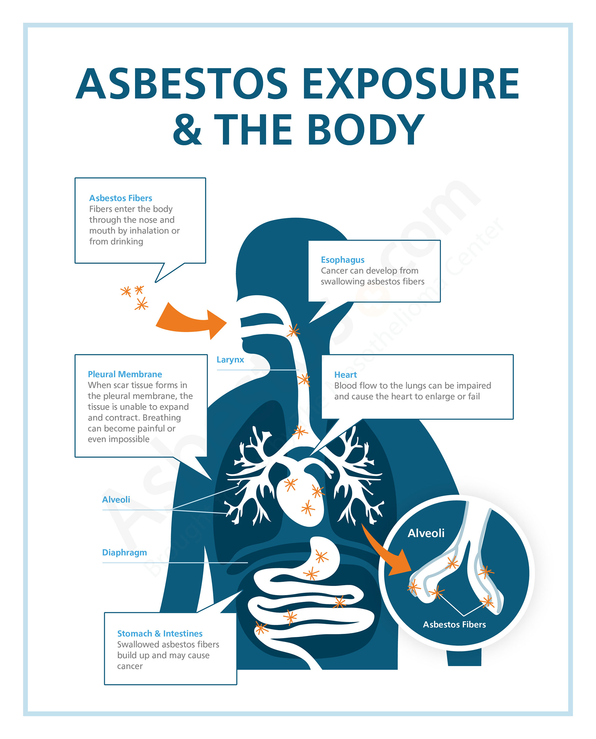 Asbestos Exposure - Risks in Occupations, Products & Jobsites