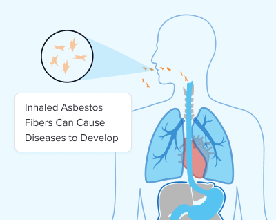 Inhaled asbestos fibers can cause diseases to develop