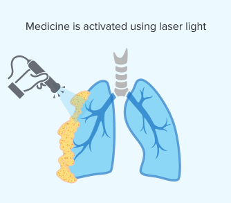 Activating the photodynamic drug with laser light