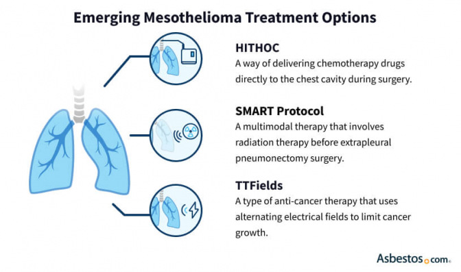 New Mesothelioma Treatments How To Access Emerging Treatments   Latest Mesothelioma Treatment Options 672x0 C Default 