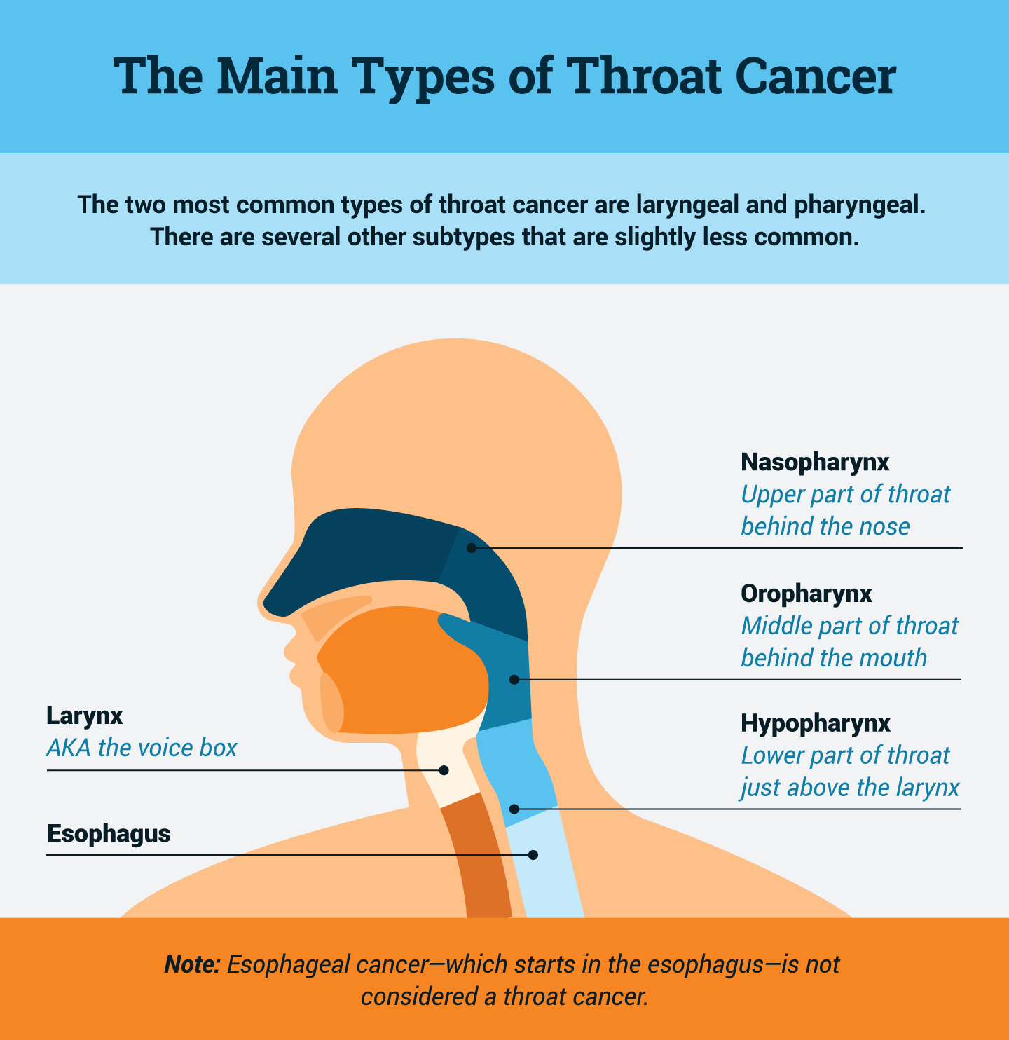 Throat Cancer Diagram