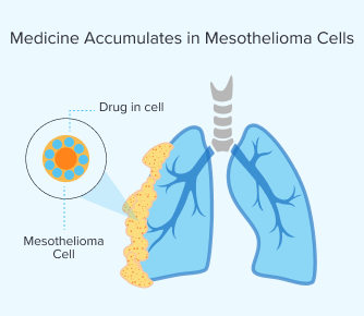 Medicine accumulates in mesothelioma cells