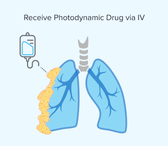 Receiving a photodynamic drug via IV