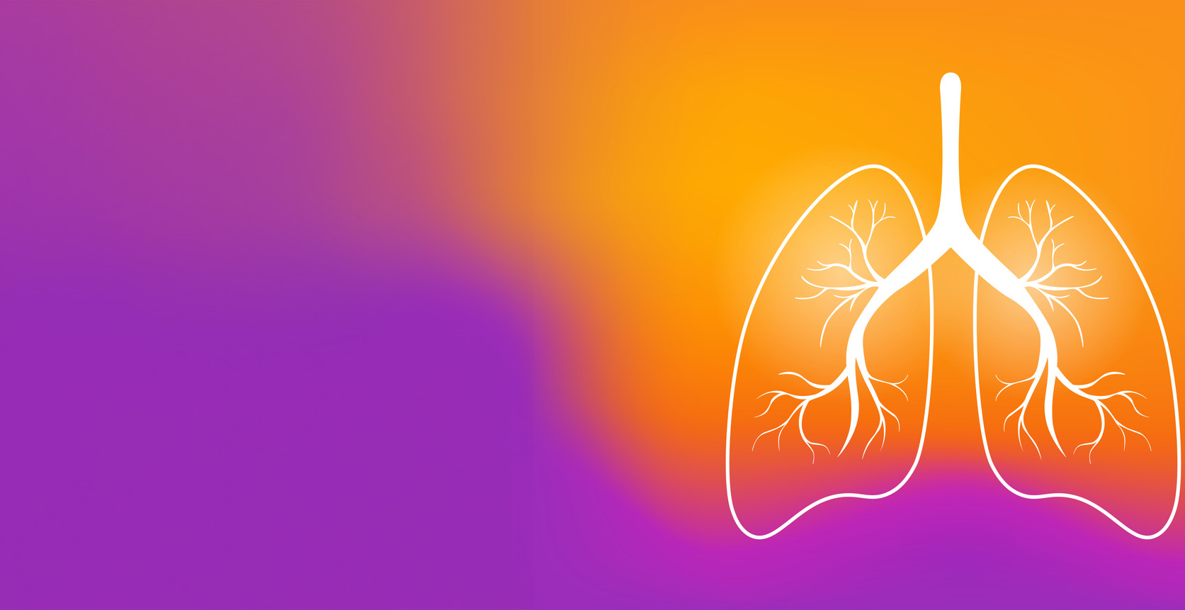 Free Webinar: Treating Pleural Mesothelioma