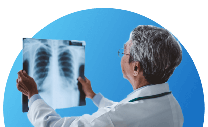 Doctor reviewing xray of lungs